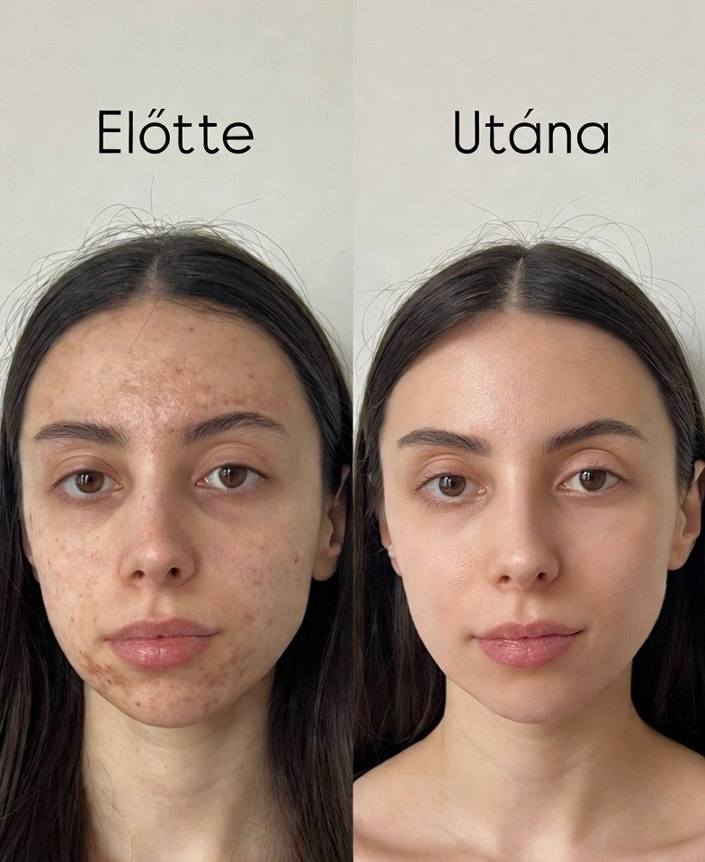 Éjszakai kollagén lehúzható maszk