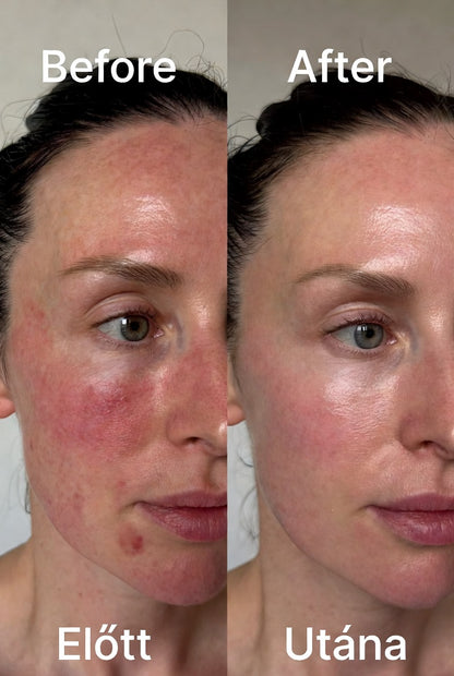 Éjszakai kollagén lehúzható maszk