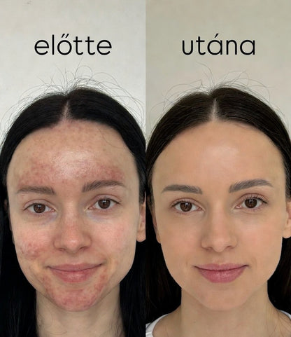 Éjszakai kollagén lehúzható maszk